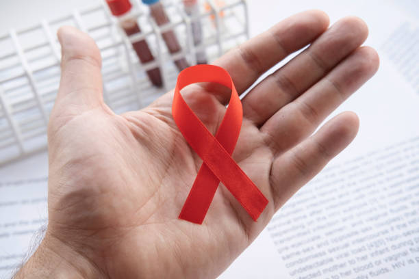 diagnosticien retenant dans la main un ruban rouge un signe de hiv. - test du sida photos et images de collection
