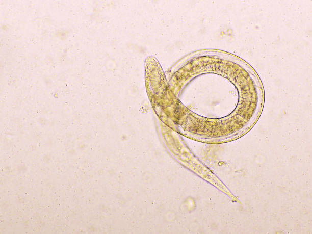 istock Strongyloides stercoralis or threadworm in human stool 1187835288