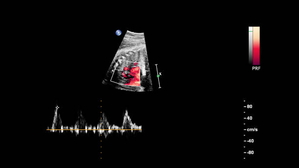 태아 심초음파가있는 초음파 스크린. - nexrad 뉴스 사진 이미지
