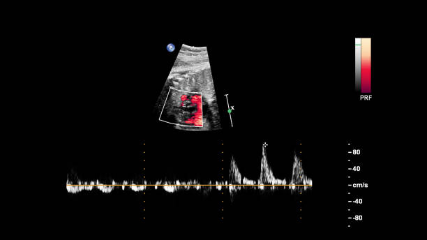 태아 심초음파가있는 초음파 스크린. - nexrad 뉴스 사진 이미지