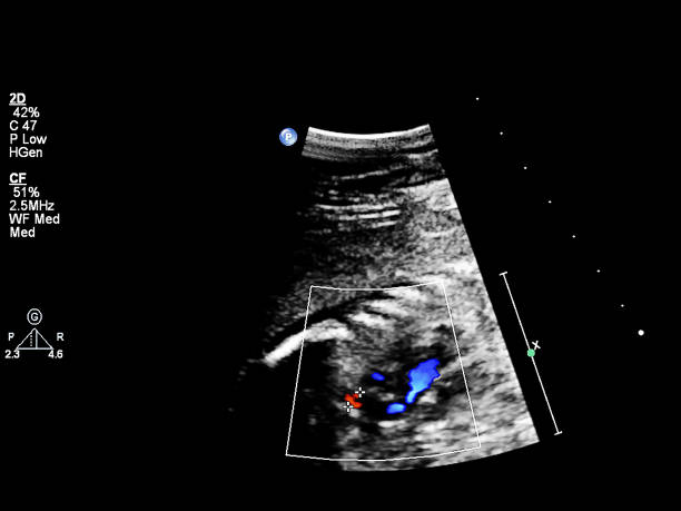 태아 심초음파가있는 초음파 스크린. - nexrad 뉴스 사진 이미지