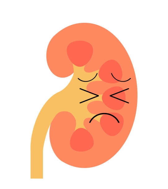 Suffering kidney The kidney has a painful expression. pyelitis stock illustrations