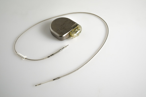 An Implantable Cardioverter Defibrillator or ICD pacemaker with leads and modem for telemonitoring at home. The device sends data to the hospital on a regular basis.