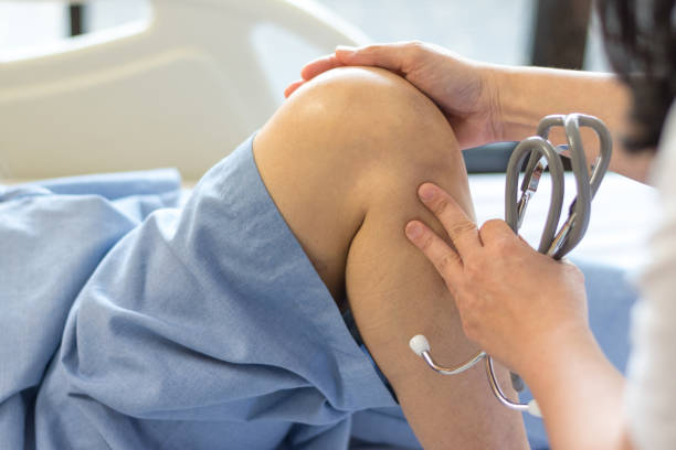 통통증 증후군 개념. 의사 검진 또는 검진 환자 무릎 뼈와 관절 은 팔개기 감염과 골연골염에 대한. - cartilage patella human knee medical exam 뉴스 사진 이미지