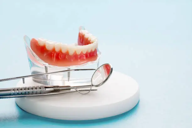 Teeth model showing an implant crown bridge model/ dental demonstration teeth study teach model.