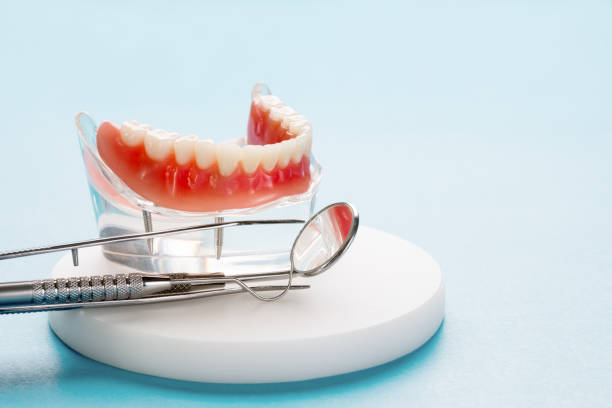 модель зубов, показывающая модель моста коронки имплантата. - laboratory dentures dental hygiene human teeth стоковые фото и изображения