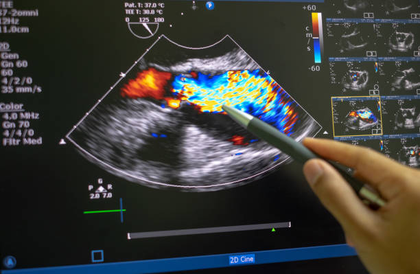 Echocardiography (ultrasound). Echocardiography (ultrasound) machine. doppler of aortic stenosis aorta photos stock pictures, royalty-free photos & images