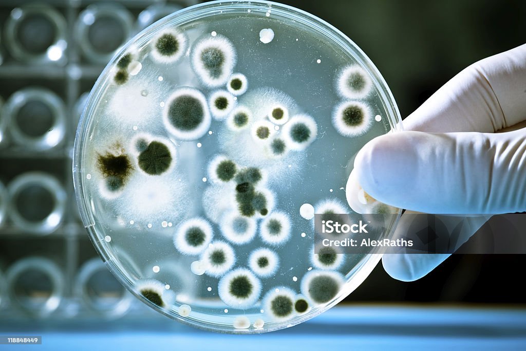 Laboratory petri dish with growing bacteria Gloved hand holding a Petri dish with bacteriaю Agar Jelly Stock Photo