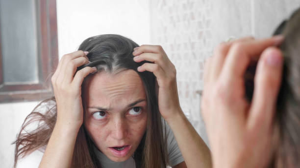 Young woman is looking at her hairs in front of the mirror in bathroom. Portrait of young woman fingering her hairs, in horror considering the appearance of gray hair and dandruff. Portrait shot in mirror reflection. gray hair young woman stock pictures, royalty-free photos & images