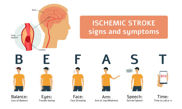 ilustrações, clipart, desenhos animados e ícones de sinais e sintomas isquêmicos do curso - infográfico médico do cérebro humano e do homem liso dos desenhos animados ajustados - stroke vascular symptoms patient