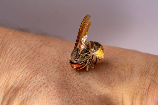 スズメバチがマナの手を噛む - angioedema ストックフォトと画像