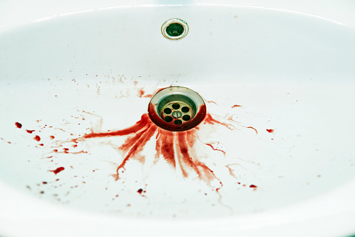 Red floods of blood dripple to the white washbasin drain. Bathroom sink is soiled with blood stains. Unhealthy state. Bleeding human has spitted into washbowl. Fatal outcome. Painful illness.