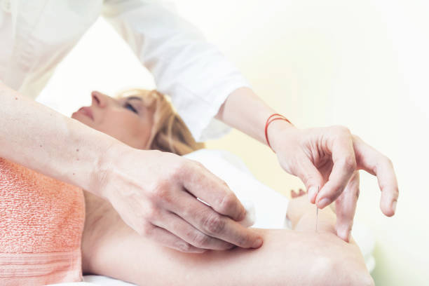 istock Woman on acupuncture 1188858308