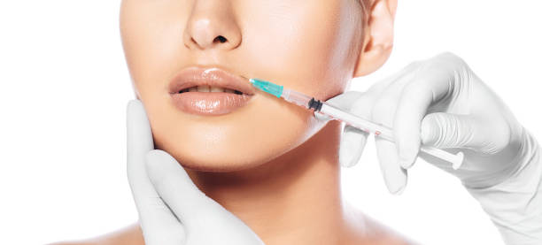 istock Cropped female face during lips augmentation procedure. Injections for increase lips shape 1188883720
