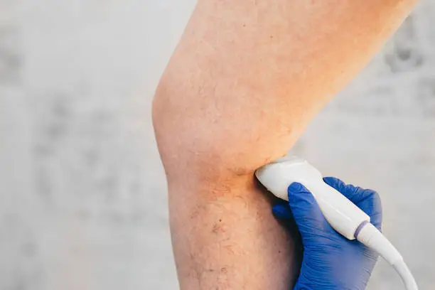 Photo of cropped ultrasound exam veins on the leg, vein thrombosis, varicose veins