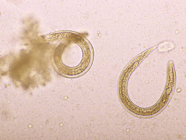 istock Strongyloides stercoralis or threadworm in human stool 1189163398