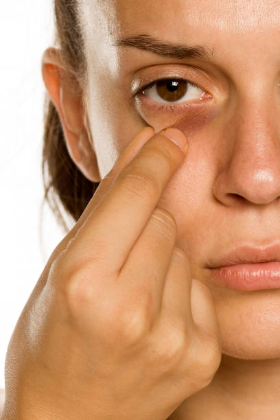 istock Young woman touching her low eyelids on yellow background 1189321564