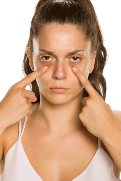 istock Young woman touching her low eyelids on yellow background 1189321574