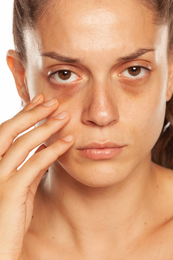 Young woman touching her low eyelids on yellow background