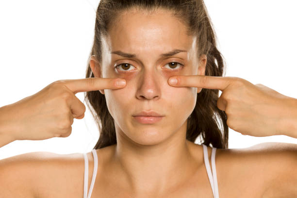 istock Young woman touching her low eyelids on yellow background 1189321589