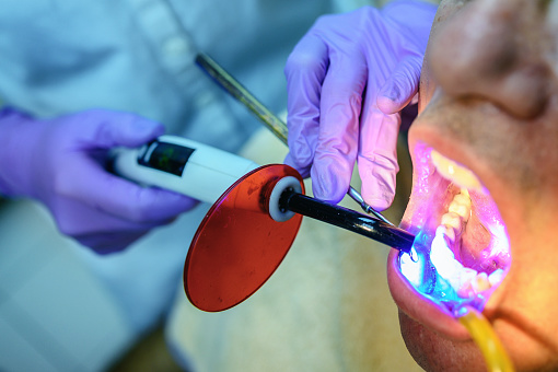 Mature man having dental check up in dental clinic. Dentistry Dentist working Ultraviolet Light Cure Fillings Teeth Dental Process Dental Health