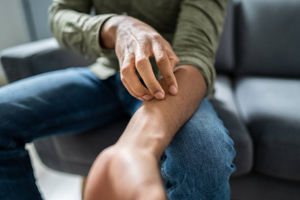 istock Close-up Of An Man Scratching His Hand 1189507331