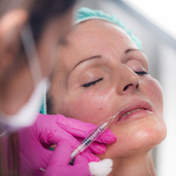 istock Hyaluronic Acid Fillers for Lips 1189572962