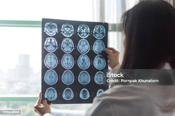 클리닉 병원에서 일하는 방사선 전문의 종양학과 뇌의 Mri 디지털 엑스레이 의료 의료 개념 다발성 경화증에 대한 스톡 사진 및 기타 이미지