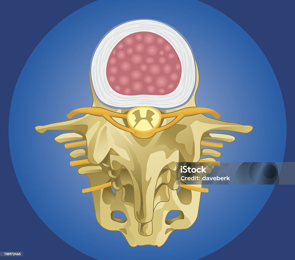 Anatomie de la colonne arborant Intervertebral cent - clipart vectoriel de Facette articulaire libre de droits