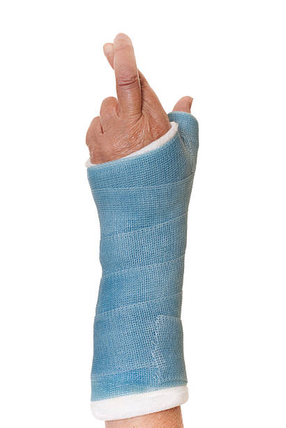 Hand and arm in cast with fingers crossed for luck stock photo