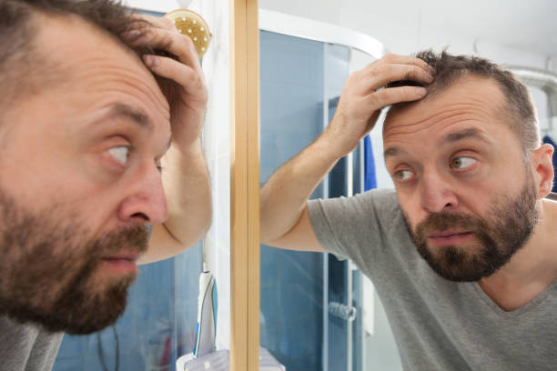 istock Worried man looking at his decreasing hairline 1190036788