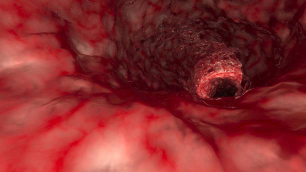 inside artery or intestine - anatomy blood animal vein human artery imagens e fotografias de stock