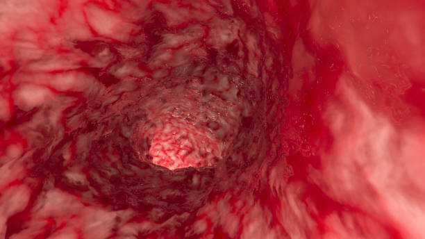 wewnątrz tętnicy lub jelita - blood human vein animal vein human blood vessel zdjęcia i obrazy z banku zdjęć
