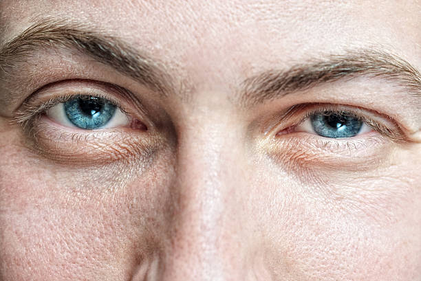 male face with enlarged pores and blue eyes stock photo