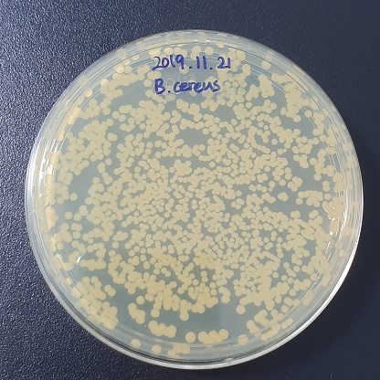 Laboratory Microbial Growth Promotion Test