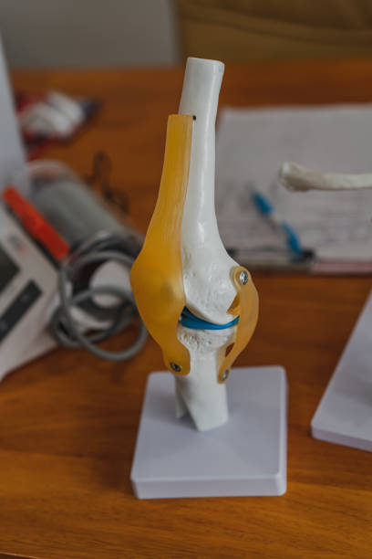 istock Knee joint model on table in Physiotherapy clinic 1190643585