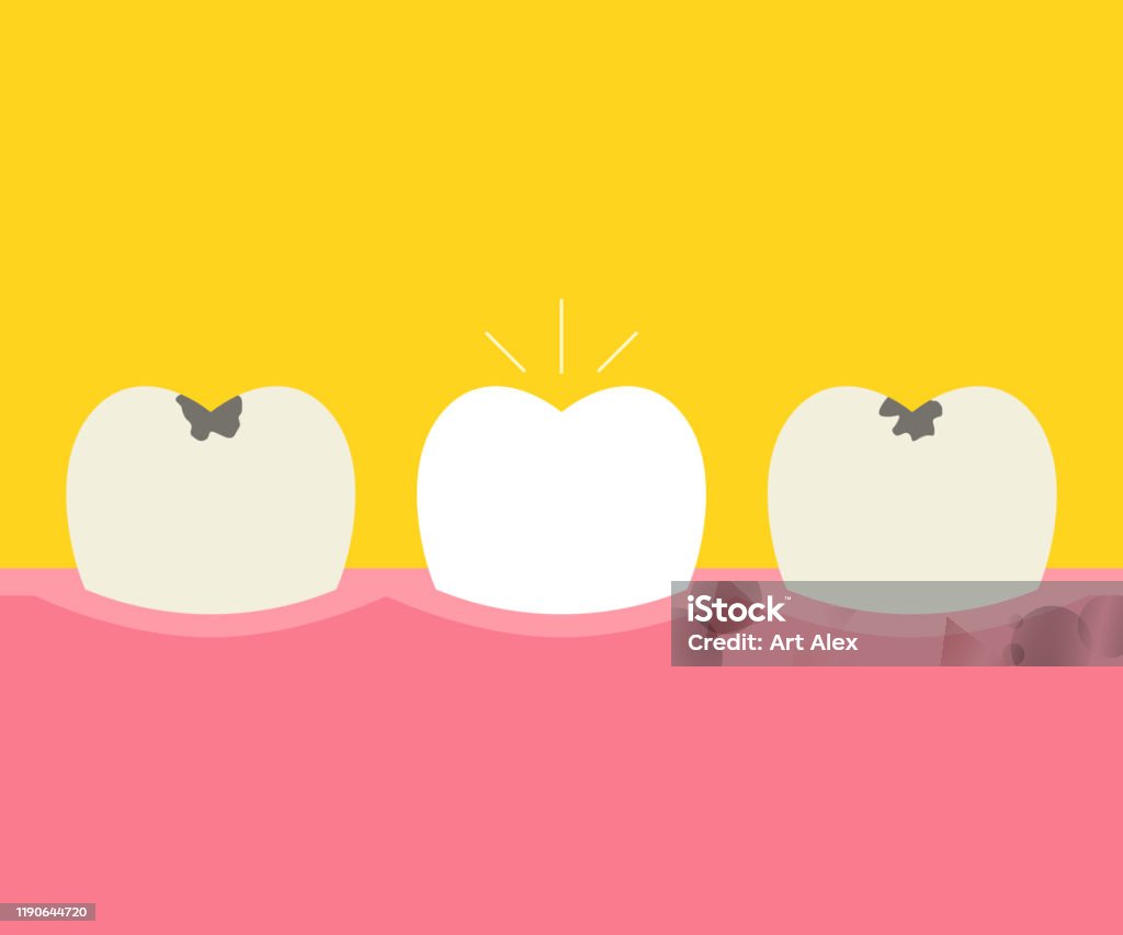 Clearing Tooth Before And After Whitening Oral Care Concept Deep Cleaning Clearing ...