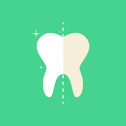 Clearing Tooth Before And After Whitening Oral Care Concept Deep Cleaning Clearing ...