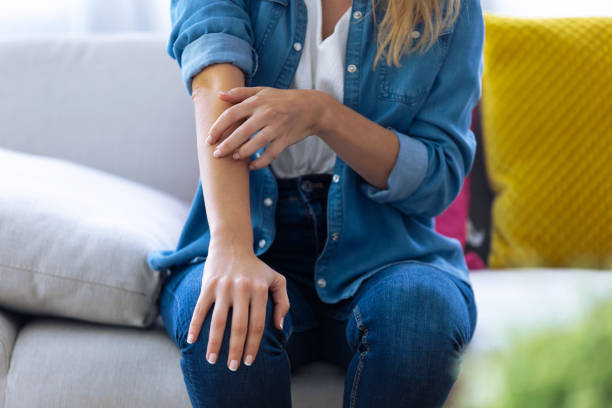mulher nova que risca seu braço ao sentar-se no sofá em casa. - dermatitis dry human hand human skin - fotografias e filmes do acervo