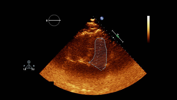 心臓画像を持つ超音波装置の画面。 - pulmonary valve ストックフォトと画像