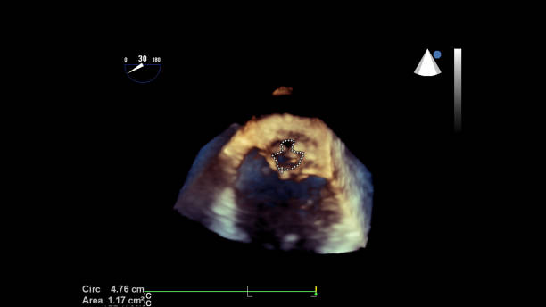 istock Screen of an ultrasound machine with a heart image. 1190959086
