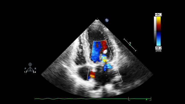 심장 이미지가있는 초음파 기계의 화면. - nexrad 뉴스 사진 이미지