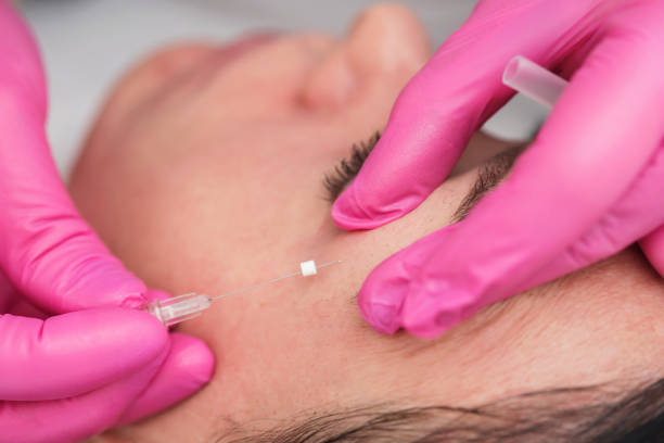 istock Mezonites non-invasive face lift 1191039840