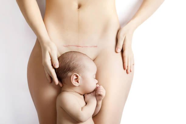 彼女の腹にcセクションの後に傷跡を持つ新生児と彼の母親 - abdomen adult affectionate baby ストックフォトと画像