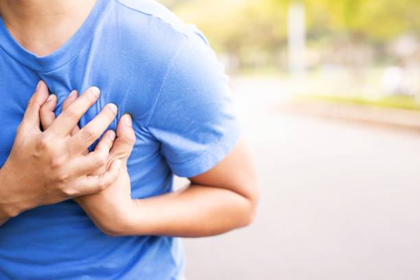 A man has an acute heart attack while running in the park. stock photo