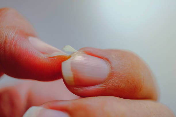 гвоздь на разрыв указательного пальца. вызвать боль в кончиках пальцев. - dry skin close up horizontal macro стоковые фото и изображения