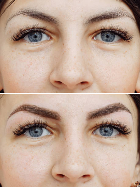 istock Photo comparison before and after permanent makeup, tattooing of eyebrows 1192643237