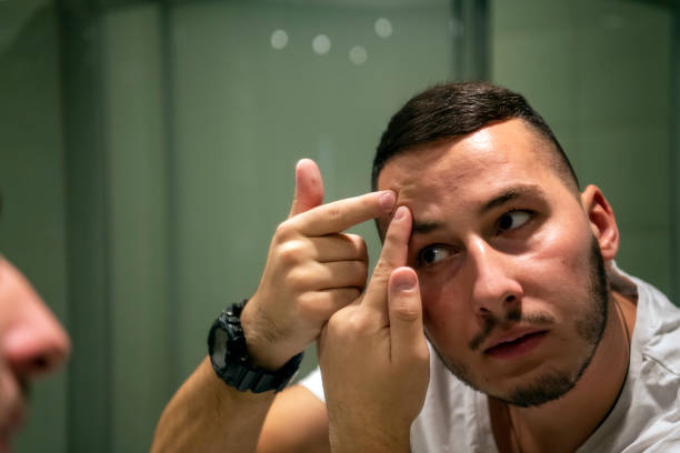 istock Young Man is Squeezing Acne in Front of the Mirror 1192651168