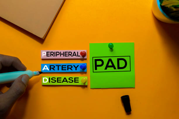 PAD. Peripheral Artery Disease acronym on sticky notes. Office desk background PAD. Peripheral Artery Disease acronym on sticky notes. Office desk background artery photos stock pictures, royalty-free photos & images