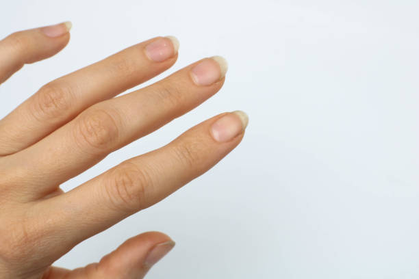 istock Close up five dirty hand nails on white background have copy space for put text. Concept unhealthy because can have bacteria make sick people 1192862313